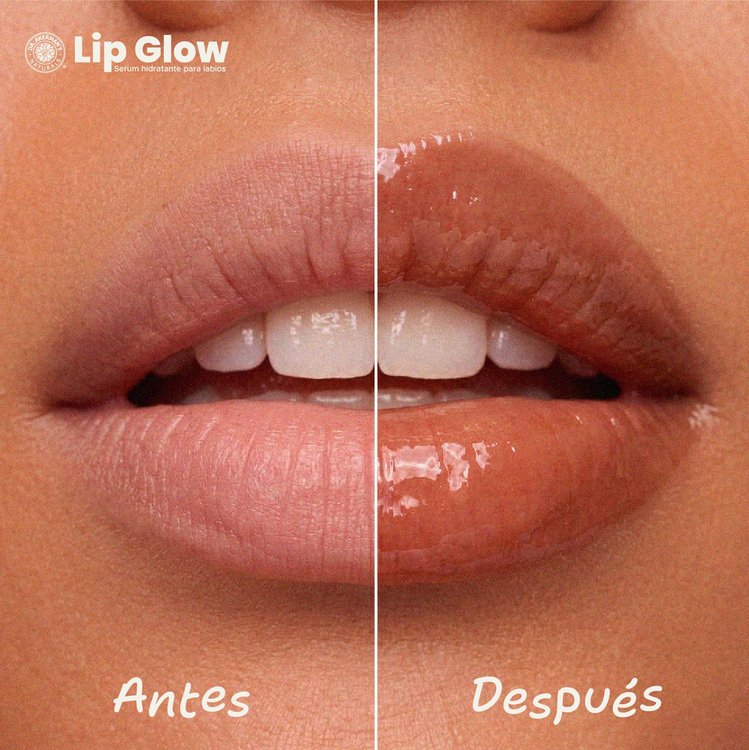 Lip Glow Serum Caramel Latte Dr Akerman´s Ultra Hidratante Filler Progresivo No pegajoso