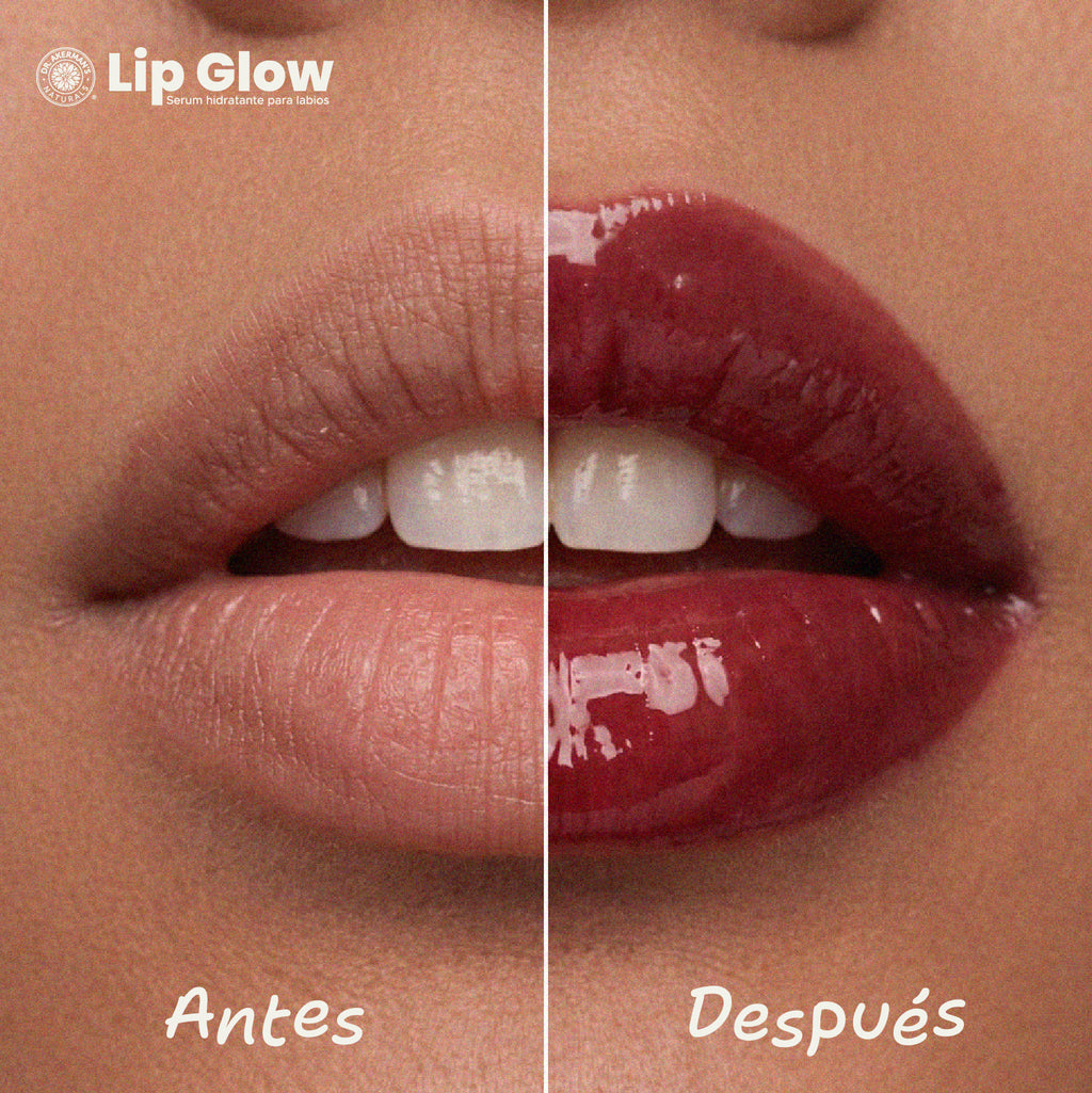Lip Glow Serum Cherry Soda Dr Akerman´s Ultra Hidratante Filler Progresivo No pegajoso