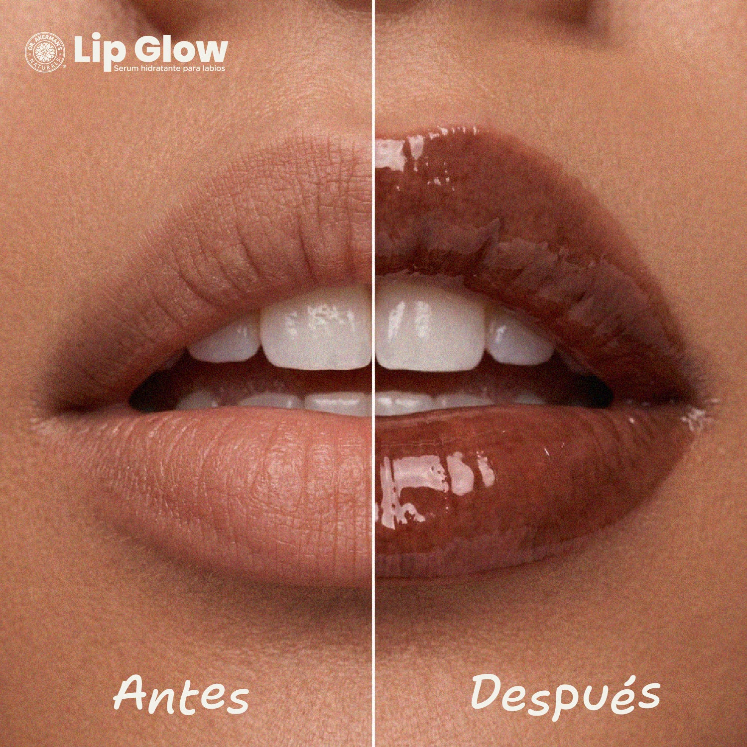 Lip Glow Serum Hot Chocolate Dr Akerman´s Ultra Hidratante Filler Progresivo No pegajoso
