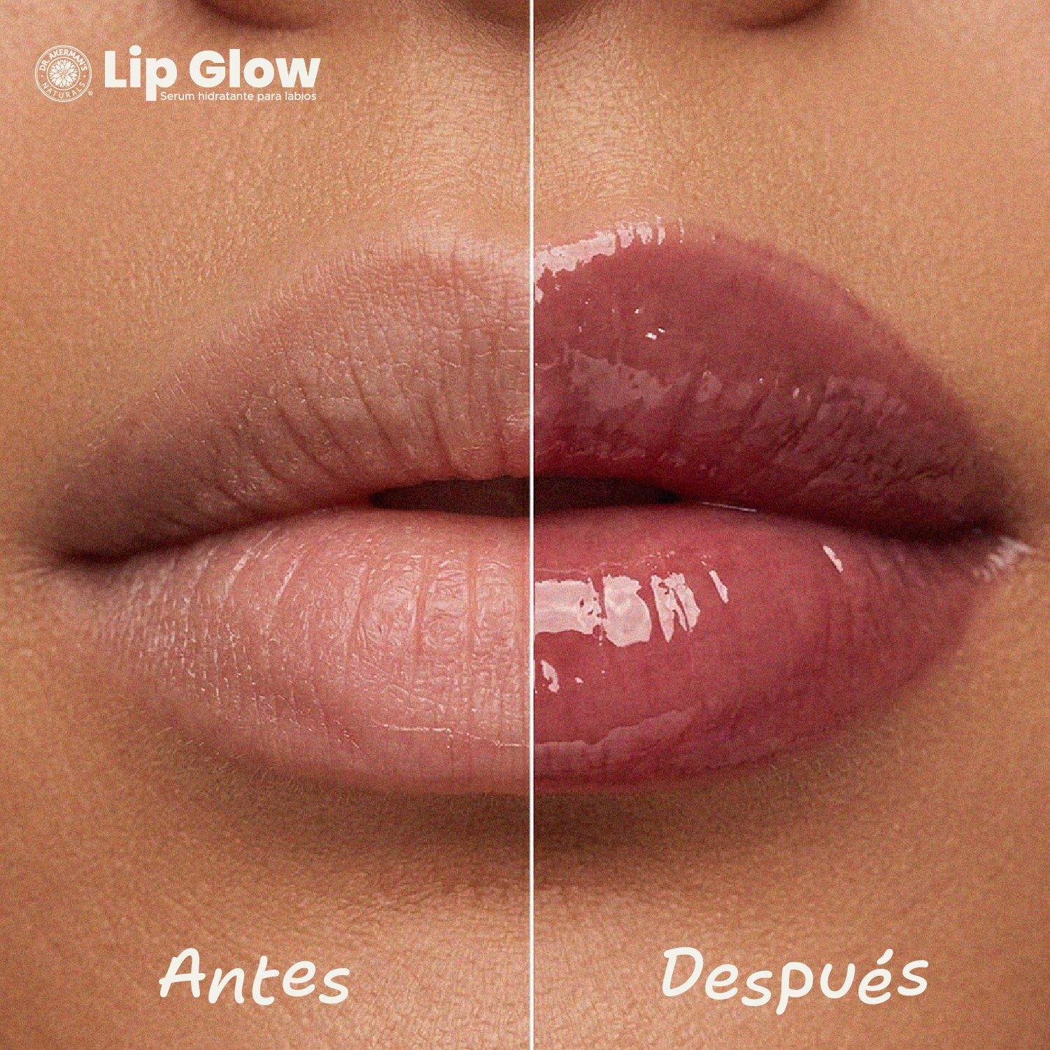 Lip Glow Serum Pink Lemonade Dr Akerman´s Ultra Hidratante Filler Progresivo No pegajoso