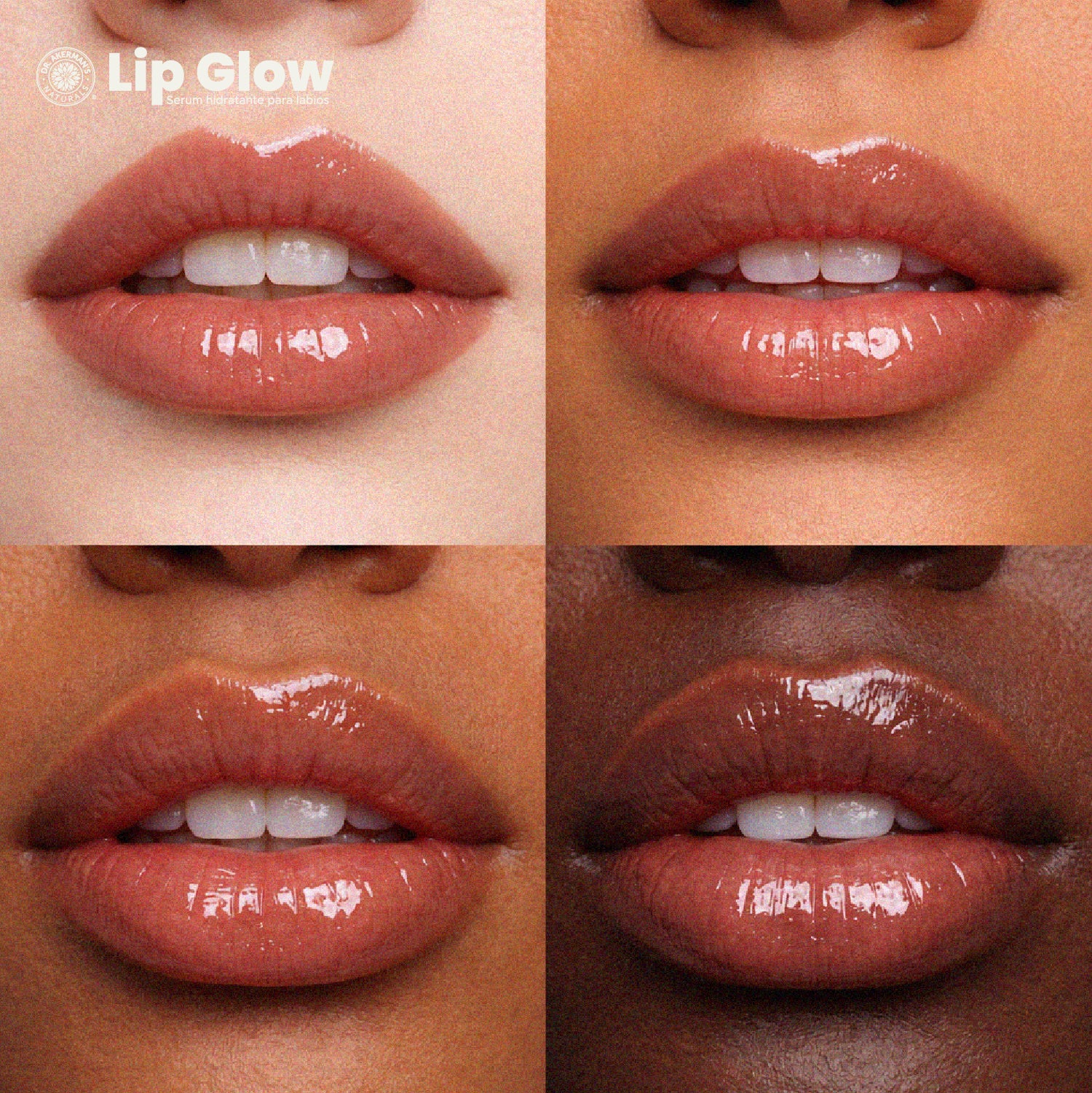 Lip Glow Serum Caramel Latte Dr Akerman´s Ultra Hidratante Filler Progresivo No pegajoso