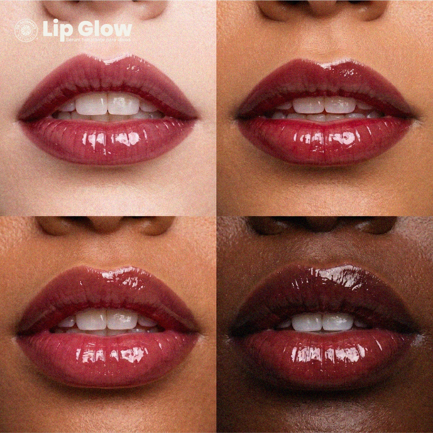 Lip Glow Serum Cherry Soda Dr Akerman´s Ultra Hidratante Filler Progresivo No pegajoso